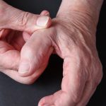 Action Rehab - Thumb Arthritis - Carpometacarpal Osteoarthritis
