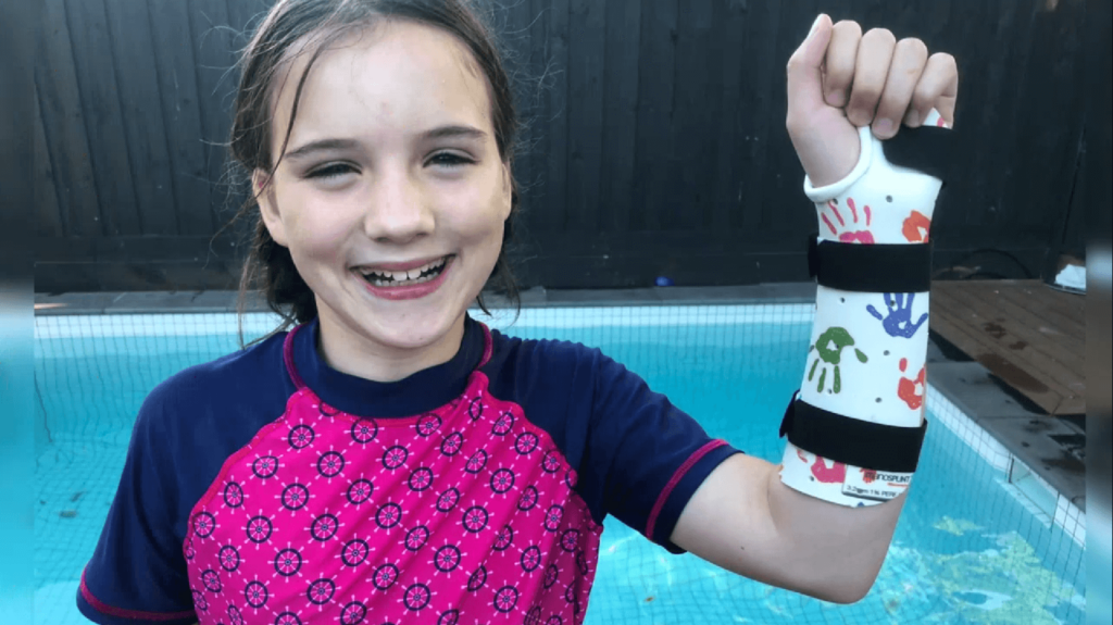 Custom-made Thermoplastic Splints and Casts | Action Rehab