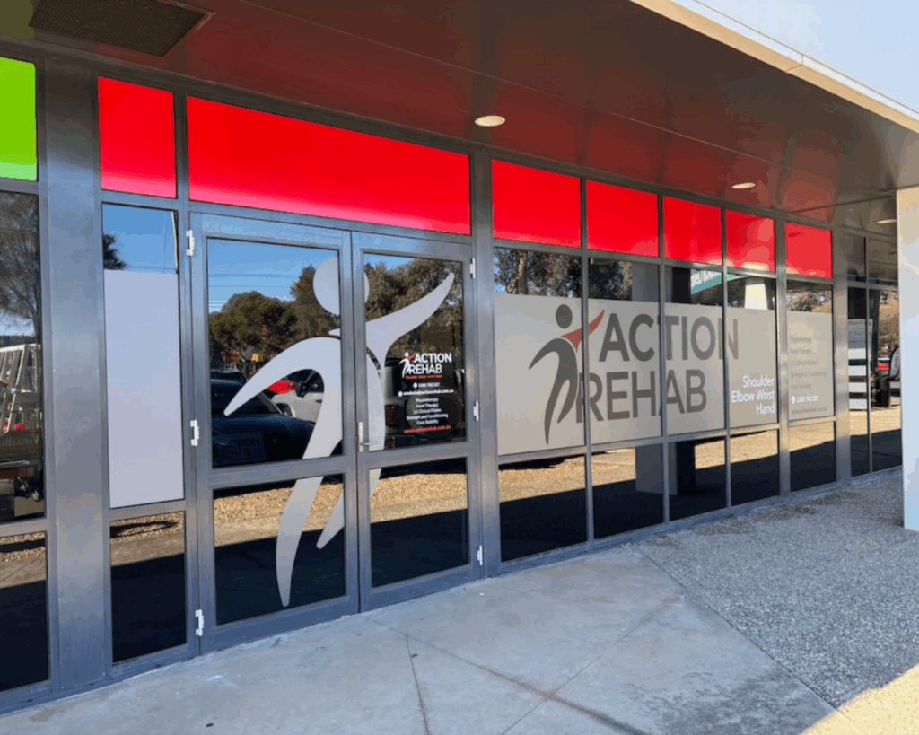 Hypermobility | Action Rehab - Shoulder, Elbow, Wrist and Hand Physiotherapists Action Rehab Werribee hand therapy clinic in Melbourne.