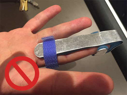 Central Slip Injury | Action Rehab - Shoulder, Elbow, Wrist and Hand Physiotherapists Trigger Finger Incorrect Treatment