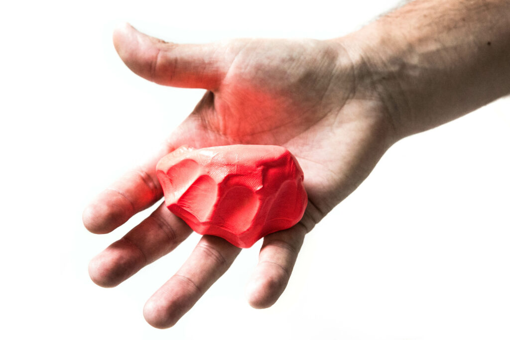 Tendon Injury - Jersey Finger | Action Rehab - Shoulder, Elbow, Wrist and Hand Physiotherapists Melbourne Physiotherapy Services | Action Rehab