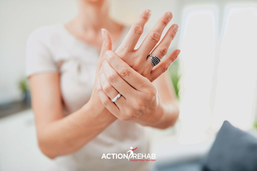 How to treat a Scaphoid fracture | Action Rehab - Shoulder, Elbow, Wrist and Hand Physiotherapists Scaphoid Fracture | Action Rehab