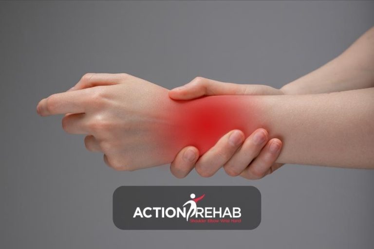 Wrist Fractures and Osteoporosis: Understanding the Connection | Action Rehab - Shoulder, Elbow, Wrist and Hand Physiotherapists Wrist Fractures and Osteoporosis: Understanding the Connection between