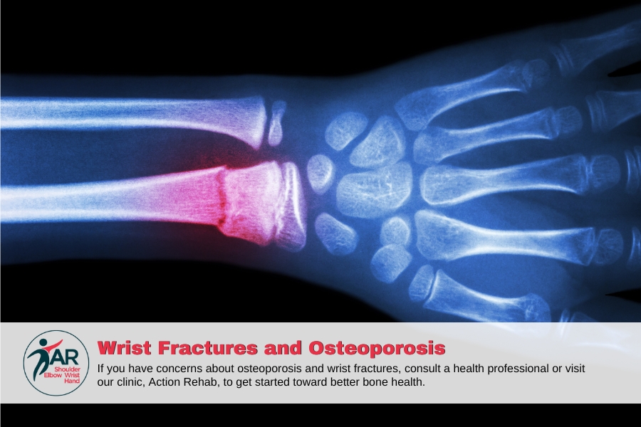 Wrist Fractures and Osteoporosis: Understanding the Connection | Action Rehab - Shoulder, Elbow, Wrist and Hand Physiotherapists Wrist Fractures and Osteoporosis: Understanding the Connection between