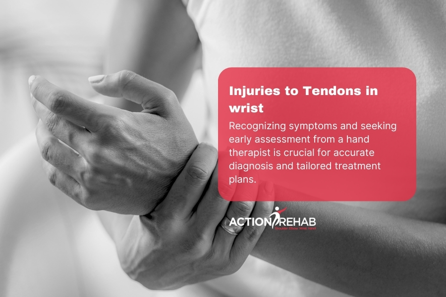 Injuries to Tendons in wrist – ECU and FCU Tendinopathies | Action Rehab - Shoulder, Elbow, Wrist and Hand Physiotherapists Injuries to Tendons in wrist – ECU and FCU Tendinopathies | Action Rehab Hand Therapy