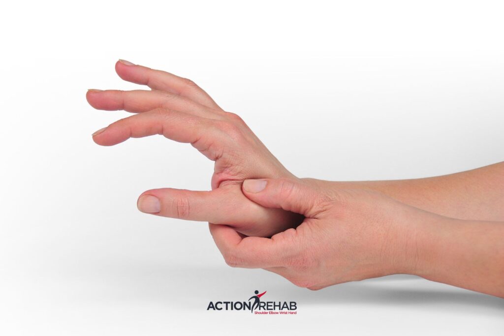 De Quervain’s Tenosynovitis and Scapholunate Instability | Action Rehab Hand Therapy