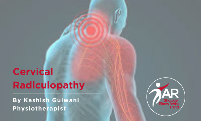 Cervical Radiculopathy | Action Rehab - Shoulder, Elbow, Wrist and Hand Physiotherapists Cervical Radiculopathy