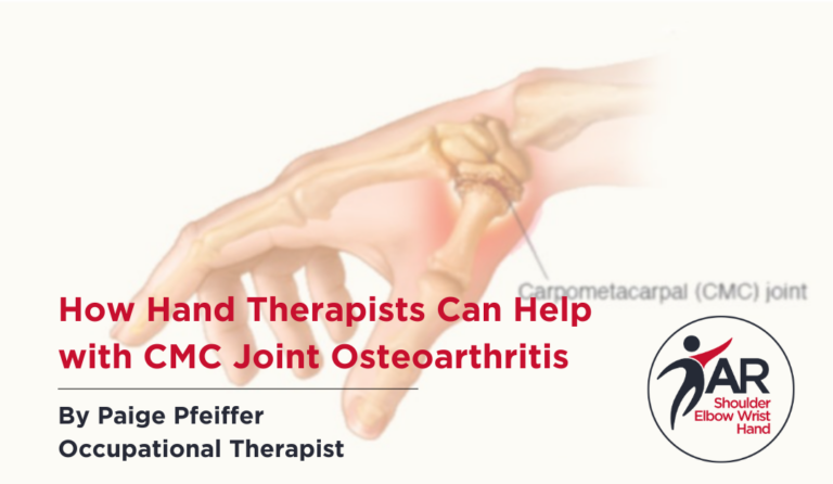 How Hand Therapists Can Help with CMC Joint Osteoarthritis (OA) | Action Rehab - Shoulder, Elbow, Wrist and Hand Physiotherapists How Hand Therapists Can Help with CMC Joint Osteoarthritis (OA)