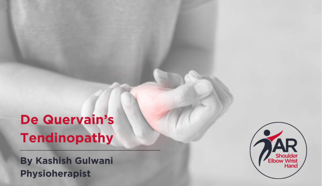 De Quervain’s tendinopathy by Kashish Gulwani Action Rehab