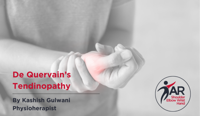 Understanding De Quervain’s Tendinopathy and How to Treat It | Action Rehab - Shoulder, Elbow, Wrist and Hand Physiotherapists De Quervain’s tendinopathy by Kashish Gulwani Action Rehab