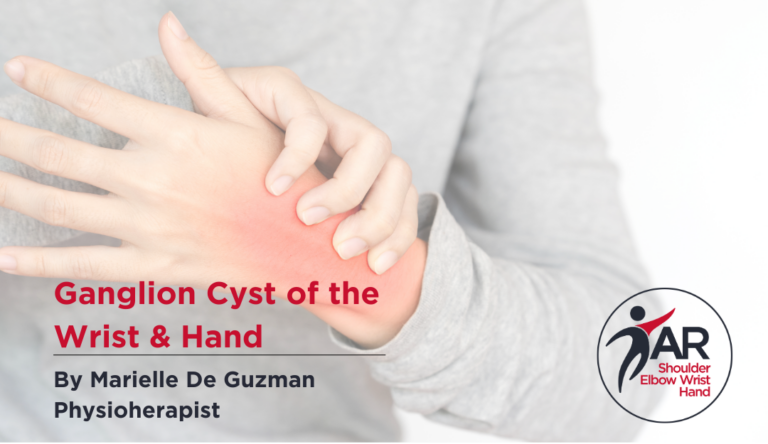Ganglion Cyst of the Wrist and Hand | Action Rehab - Shoulder, Elbow, Wrist and Hand Physiotherapists Ganglion Cyst of the Wrist and Hand