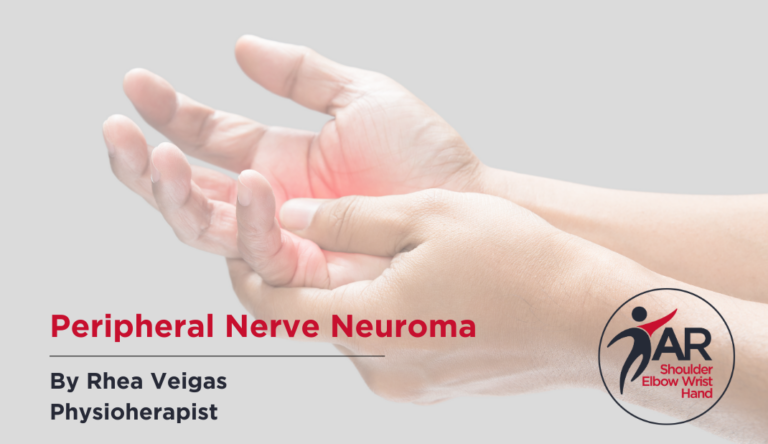 Peripheral Nerve Neuroma | Action Rehab - Shoulder, Elbow, Wrist and Hand Physiotherapists Peripheral Nerve Neuroma