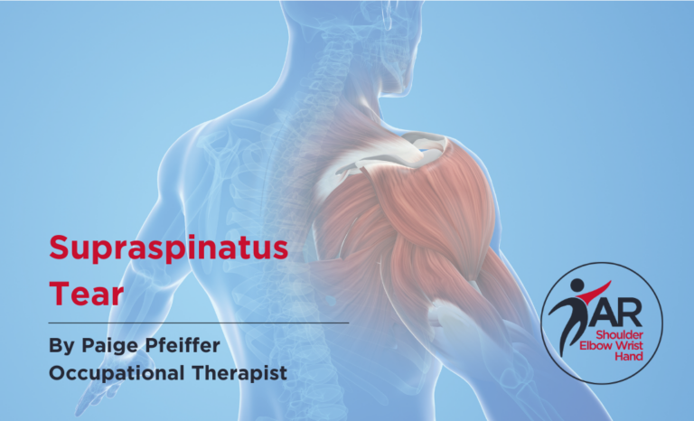 Supraspinatus Tear | Action Rehab - Shoulder, Elbow, Wrist and Hand Physiotherapists Supraspinatus Tear