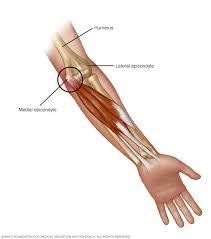 GOLFER’S ELBOW (MEDIAL EPICONDYLITIS) | Action Rehab - Shoulder, Elbow, Wrist and Hand Physiotherapists GOLFER’S ELBOW (MEDIAL EPICONDYLITIS) | Action Rehab - Shoulder, Elbow, Wrist and Hand Physiotherapists