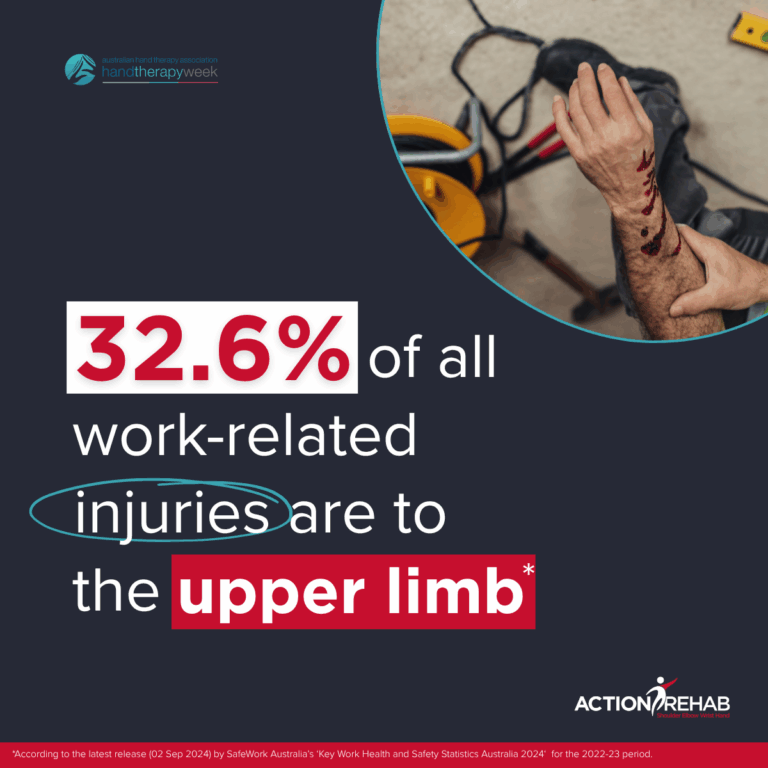 Over 32% of work-related injuries are to the Upper Limb: Early intervention can help reduce the risk | Action Rehab - Shoulder, Elbow, Wrist and Hand Physiotherapists Over 32% of work-related injuries are to the Upper Limb: Early intervention can help reduce the risk | Action Rehab - Shoulder, Elbow, Wrist and Hand Physiotherapists