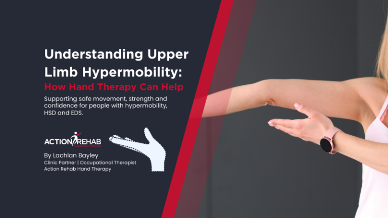 Hypermobility in the Upper Limb: How Hand Therapy can provide support | Action Rehab - Shoulder, Elbow, Wrist and Hand Physiotherapists Hypermobility in the Upper Limb: How Hand Therapy can provide support