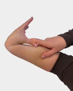 Hand and wrist demonstrating increased thumb extension often seen in hypermobility spectrum disorders and HSD/EDS.