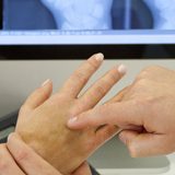 Metacarpal Fracture Treatment Metacarpal Fracture Treatment | Action Rehab